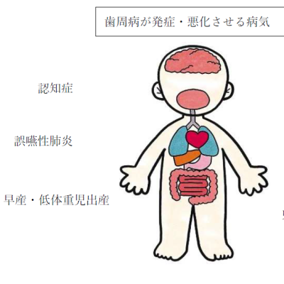 歯周病が発症・悪化させる病気